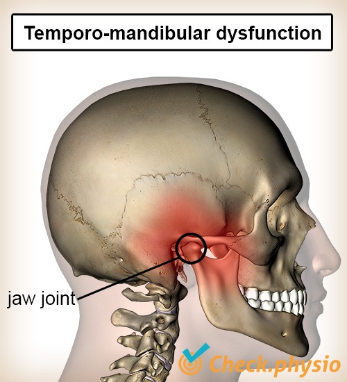 head jaw disc disfunction temporomandibular joint