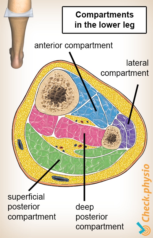 lower leg compartment syndrome cross section muscles