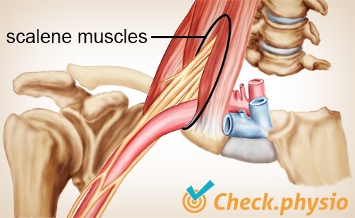 shoulder arm hand thoracic outlet syndrome scalene triangle